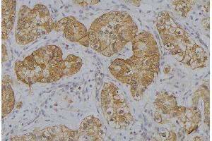 ABIN6273634 at 1/100 staining Human uterus tissue by IHC-P. (HSP77/76 Antikörper)