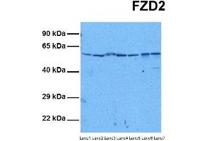 Host:  Rabbit  Target Name:  FZD2  Sample Tissue:  Human HepG2, Human Jurkat, Human MCF7, Human DLD1, Human Hela, Human Fetal Liver, Human Stomach Tumor  Antibody Dilution:  1. (FZD2 Antikörper  (N-Term))