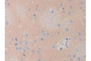 IHC-P analysis of Rat Cerebrum Tissue, with DAB staining. (LCAT Antikörper  (AA 290-434))