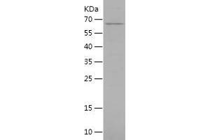 Western Blotting (WB) image for NAD Dependent Malate Dehydrogenase (NAD-ME) (AA 19-584) protein (His tag) (ABIN7124100) (NAD-ME Protein (AA 19-584) (His tag))