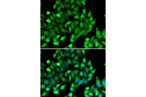 Immunofluorescence analysis of U20S cell using STAT4 antibody. (STAT4 Antikörper)