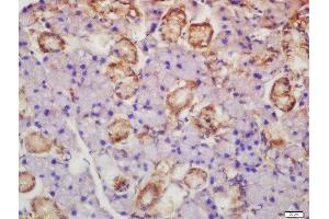 Formalin-fixed and paraffin embedded rat lymph node labeled with Rabbit Anti-Axin 2 Polyclonal Antibody, Unconjugated  at 1:200 followed by conjugation to the secondary antibody and DAB staining