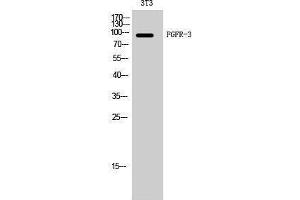 Western Blotting (WB) image for anti-Fibroblast Growth Factor Receptor 3 (FGFR3) (Internal Region) antibody (ABIN3184616) (FGFR3 Antikörper  (Internal Region))