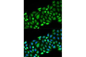Immunofluorescence analysis of HeLa cell using RIPK2 antibody. (RIPK2 Antikörper  (AA 1-540))