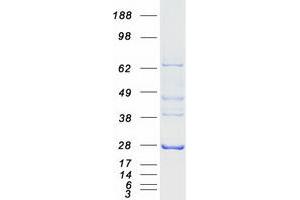 Adenylate Kinase 4 (AK4) (Transcript Variant 6) protein (Myc-DYKDDDDK Tag)