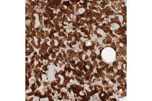 Immunohistochemical staining (Formalin-fixed paraffin-embedded sections) of human adrenal gland with PARP4 polyclonal antibody  shows strong nuclear and cytoplasmic positivity in cortical cells. (PARP4 Antikörper  (AA 247-392))