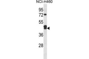 Western Blotting (WB) image for anti-Isocitrate Dehydrogenase 3 (NAD+) gamma (IDH3G) antibody (ABIN3004326) (IDH3G Antikörper)