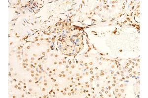 ABIN6267301 at 1/100 staining mouse kidney tissue sections by IHC-P. (EIF2S1 Antikörper  (pSer51))