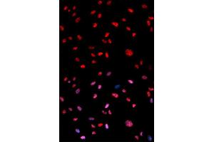 Immunofluorescence analysis of U2OS cells using Phospho-Jun-T239 antibody (ABIN5969906). (C-JUN Antikörper  (pThr239))