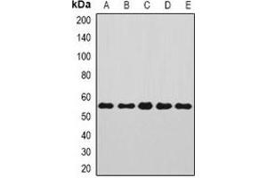 Western blot analysis of Annexin A11 expression in Jurkat (A), SKOV3 (B), A549 (C), mouse kidney (D), rat brain (E) whole cell lysates. (Annexin A11 Antikörper)