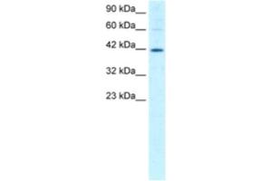 Western Blotting (WB) image for anti-Mesoderm Induction Early Response 1 (MIER1) antibody (ABIN2460961) (MIER1 Antikörper)