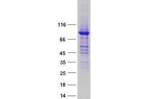 Validation with Western Blot