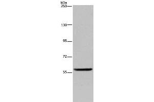 Western Blot analysis of Human fetal brain tissue using LBR Polyclonal Antibody at dilution of 1:300 (Lamin B Receptor Antikörper)
