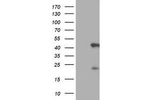 HEK293T cells were transfected with the pCMV6-ENTRY control (Left lane) or pCMV6-ENTRY SERPINB6 (Right lane) cDNA for 48 hrs and lysed. (SERPINB6 Antikörper)