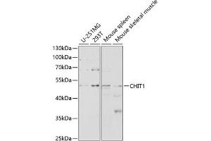 Western blot analysis of extracts of various cell lines, using CHIT1 antibody (ABIN3015832, ABIN3015833, ABIN3015834 and ABIN6219182) at 1:1000 dilution. (Chitotriosidase 1 Antikörper  (AA 217-466))