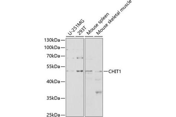 Chitotriosidase 1 抗体  (AA 217-466)