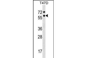 Western Blotting (WB) image for anti-General Transcription Factor IIF, Polypeptide 1, 74kDa (GTF2F1) (AA 178-206) antibody (ABIN1537966)