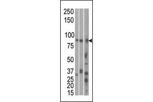 The anti-RK1 C-term Pab 7144b is used in Western blot to detect RK1 in, from left to right, Hela, T47D, and mouse brain cell line/ tissue lysate. (MARK1 Antikörper  (C-Term))