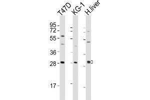 All lanes : Anti-HAVCR2 Antibody (Center) at 1:2000 dilution Lane 1: T47D whole cell lysates Lane 2: KG-1 whole cell lysates Lane 3: human liver lysates Lysates/proteins at 20 μg per lane. (TIM3 Antikörper  (AA 167-194))