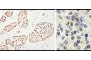 Immunohistochemistry (IHC) image for anti-RNA polymerase-associated protein RTF1 homolog (RTF1) (C-Term) antibody (ABIN7454738)