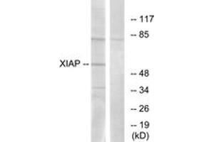 Western blot analysis of extracts from 293 cells, using XIAP (Ab-87) Antibody.