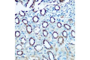 Immunohistochemistry of paraffin-embedded rat kidney using NDUFS4 Rabbit pAb (ABIN6132405, ABIN6144489, ABIN6144491 and ABIN6222016) at dilution of 1:100 (40x lens).