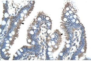 Human Intestine (RNF121 Antikörper  (N-Term))