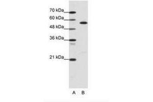 Image no. 1 for anti-Coronin, Actin Binding Protein, 1A (CORO1A) (AA 181-230) antibody (ABIN6736110) (Coronin 1a Antikörper  (AA 181-230))