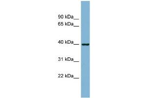 WB Suggested Anti-ELMOD2 Antibody Titration: 0. (ELMOD2 Antikörper  (N-Term))