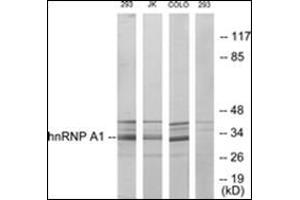 Western blot analysis of extracts from 293/Jurkat/COLO205 cells, using hnRNP A1 Antibody. (HNRNPA1 Antikörper)
