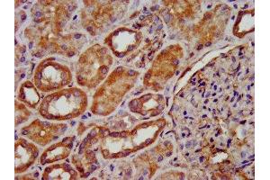 IHC image of ABIN7149571 diluted at 1:200 and staining in paraffin-embedded human kidney tissue performed on a Leica BondTM system. (PDSS2 Antikörper  (AA 292-387))