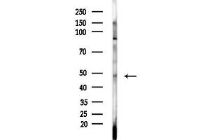 anti-Arrestin Domain Containing 1 (ARRDC1) (C-Term) antibody