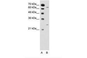 Image no. 1 for anti-N-Acetyltransferase 2 (Arylamine N-Acetyltransferase) (NAT2) (AA 151-200) antibody (ABIN205032)