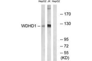 Western blot analysis of extracts from Jurkat/HepG2 cells, using WDHD1 Antibody. (WDHD1 Antikörper  (AA 721-770))