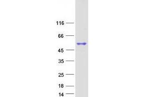 SP6 Protein (Myc-DYKDDDDK Tag)