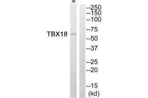 Western Blotting (WB) image for anti-T-Box 18 (TBX18) (Internal Region) antibody (ABIN1852256) (T-Box 18 Antikörper  (Internal Region))