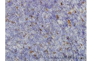 Image no. 1 for anti-Malic Enzyme 1, NADP(+)-Dependent, Cytosolic (ME1) (AA 1-573) antibody (ABIN598801) (ME1 Antikörper  (AA 1-573))