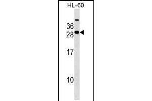 Western blot analysis in HL-60 cell line lysates (35ug/lane). (STXBP6 Antikörper  (AA 71-97))
