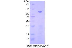 SDS-PAGE analysis of Human Meprin A alpha Protein.