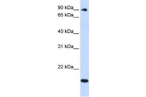 WB Suggested Anti-TSR1 Antibody Titration:  0. (TSR1 Antikörper  (Middle Region))