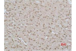 Immunohistochemistry (IHC) analysis of paraffin-embedded Rat Brain Tissue using CACNG3 Polyclonal Antibody.