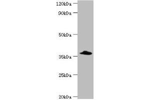 Western blot All lanes: Complement factor H-related protein 3 antibody at 6 μg/mL + Rat heart tissue Secondary Goat polyclonal to rabbit IgG at 1/10000 dilution Predicted band size: 38, 31 kDa Observed band size: 38 kDa (CFHR3 Antikörper  (AA 80-200))