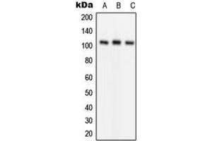 Western blot analysis of GLUR1 (pS849) expression in Jurkat (A), mouse kidney (B), rat liver (C) whole cell lysates. (Glutamate Receptor 1 Antikörper  (C-Term, pSer849))