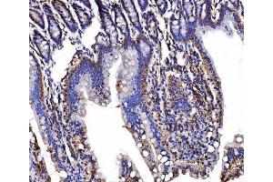 IHC analysis of LSR using anti-LSR antibody (ABIN7599514). (LSR Antikörper  (AA 1-649))