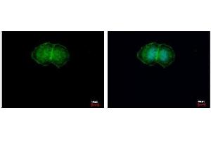 ICC/IF Image L-Plastin antibody detects LCP1 protein at membrane by immunofluorescent analysis.