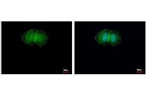 ICC/IF Image L-Plastin antibody detects LCP1 protein at membrane by immunofluorescent analysis. (LCP1 Antikörper)