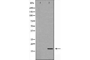 Western blot analysis of 293T whole cell lysates, using NPC2 Antibody.