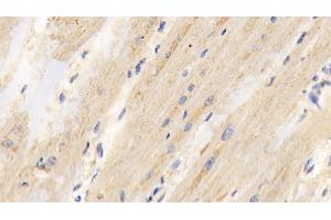 Immunohistochemistry (IHC) image for anti-Pyruvate Dehydrogenase (Lipoamide) alpha 1 (PDHA1) (AA 30-390) antibody (ABIN7432574)