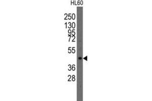 Western Blotting (WB) image for anti-LIM Homeobox Transcription Factor 1, alpha (LMX1A) antibody (ABIN2997858) (LMX1A Antikörper)