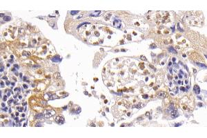 Immunohistochemistry (IHC) image for anti-BCL2-Like 1 (BCL2L1) (AA 2-212) antibody (ABIN7437176)